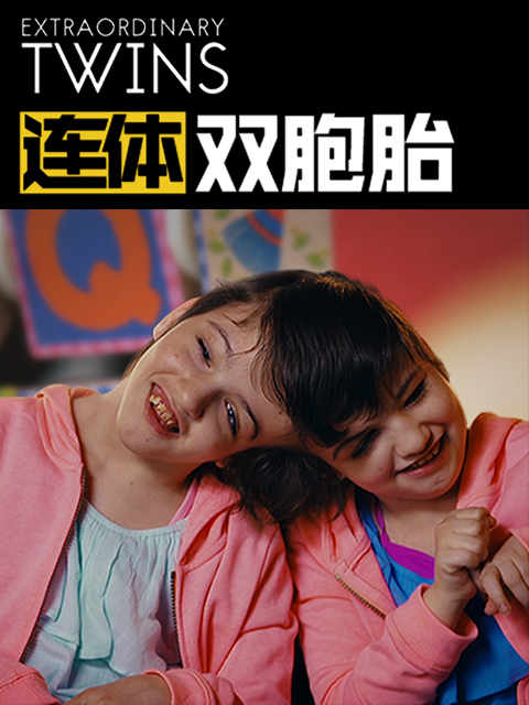 连体双胞胎}
