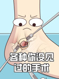 各种你没见过的手术}